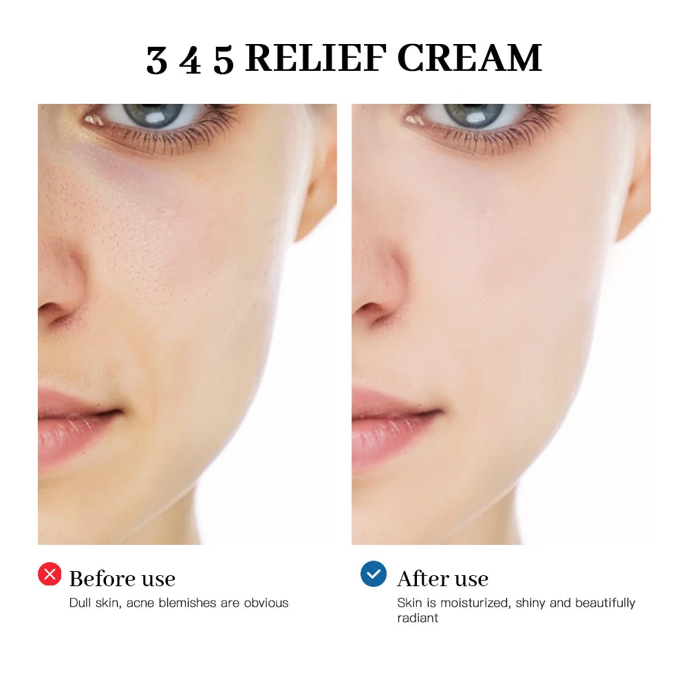 Moisturizing Face Relief Cream, 345